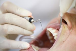 how dentists number teeth